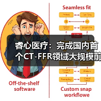 睿心医疗:完成国内首个CT-FFR领域大规模前瞻性临床试验(图4) 睿心医疗:完成国内首个CT-FFR领域大规模前瞻性临床试验(图4)