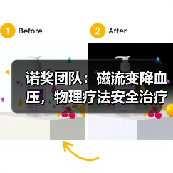 诺奖团队:磁流变降血压,物理疗法安全治疗心血管疾病(图3) 诺奖团队:磁流变降血压,物理疗法安全治疗心血管疾病(图3)