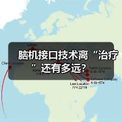 脑机接口技术离“治疗”还有多远?(图1) 脑机接口技术离“治疗”还有多远?(图1)