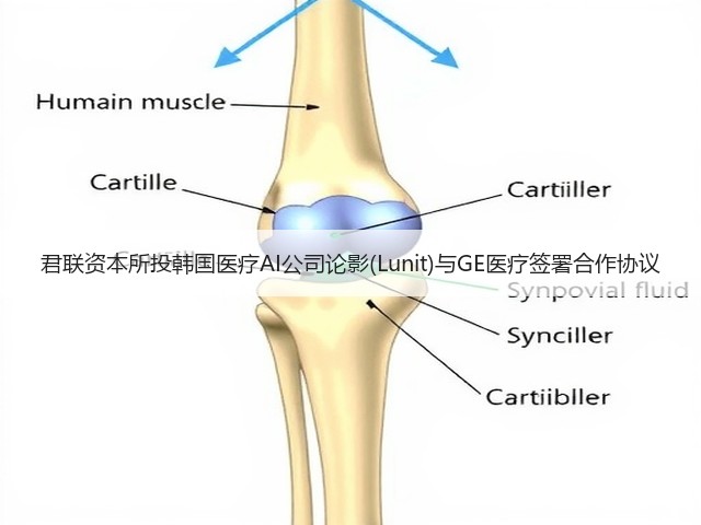 君联资本所投韩国医疗AI公司论影(Lunit)与GE医疗签署合作协议(图3)