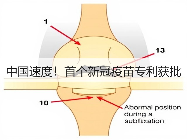 中国速度!首个新冠疫苗专利获批(图2) 中国速度!首个新冠疫苗专利获批(图2)