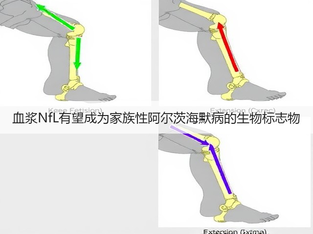 血浆NfL有望成为家族性阿尔茨海默病的生物标志物(图3)