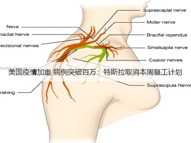 美国疫情加重 病例突破百万：特斯拉取消本周复工计划(图1)