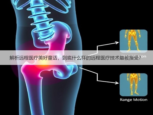 解析远程医疗美好童话,到底什么样的远程医疗技术最被接受?(图3) 解析远程医疗美好童话,到底什么样的远程医疗技术最被接受?(图3)