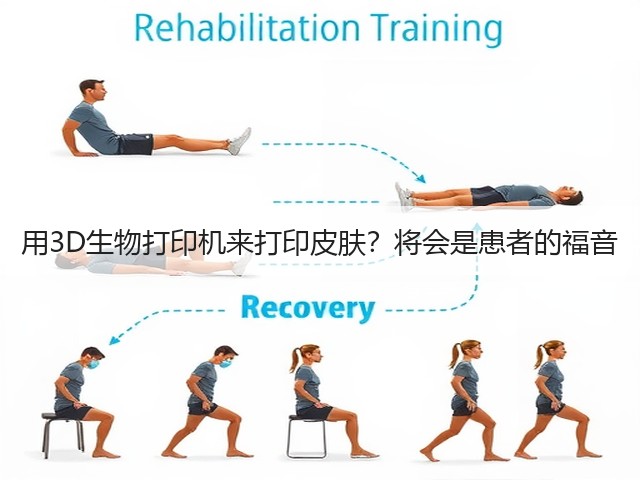 用3D生物打印机来打印皮肤？将会是患者的福音(图2)