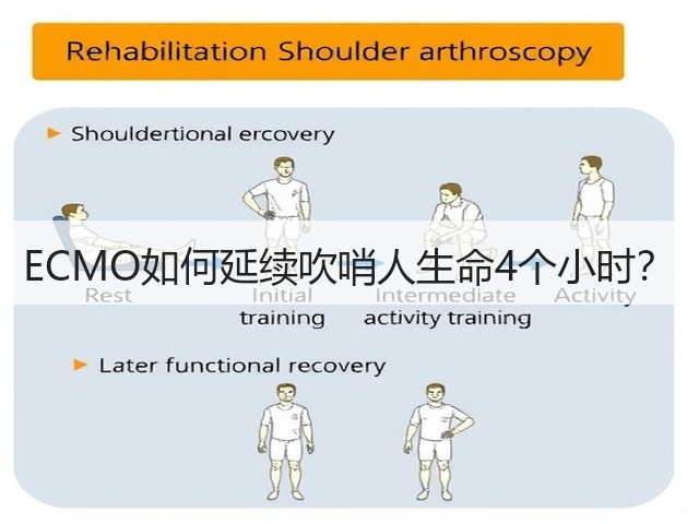 ECMO如何延续吹哨人生命4个小时?(图1) ECMO如何延续吹哨人生命4个小时?(图1)