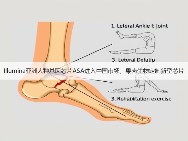 Illumina亚洲人种基因芯片ASA进入中国市场,果壳生物定制新型芯片(图1) Illumina亚洲人种基因芯片ASA进入中国市场,果壳生物定制新型芯片(图1)