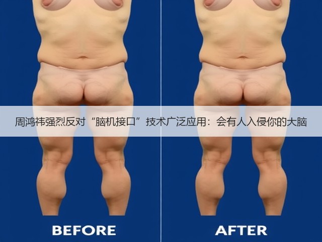 周鸿祎强烈反对“脑机接口”技术广泛应用:会有人入侵你的大脑(图3) 周鸿祎强烈反对“脑机接口”技术广泛应用:会有人入侵你的大脑(图3)