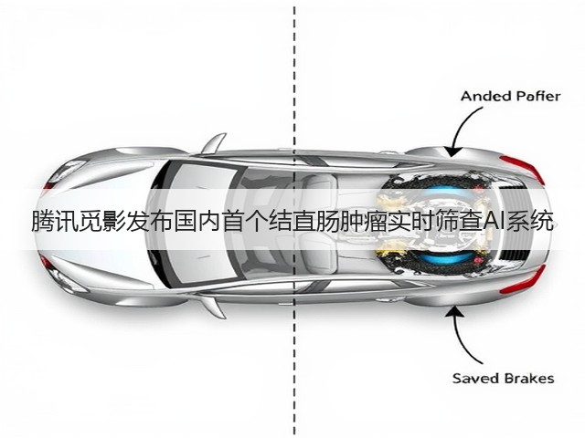 腾讯觅影发布国内首个结直肠肿瘤实时筛查AI系统(图1) 腾讯觅影发布国内首个结直肠肿瘤实时筛查AI系统(图1)