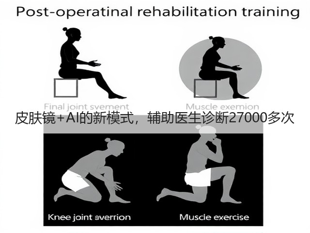 皮肤镜+AI的新模式,辅助医生诊断27000多次(图2) 皮肤镜+AI的新模式,辅助医生诊断27000多次(图2)