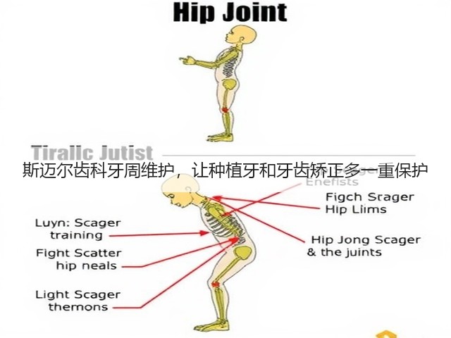 斯迈尔齿科牙周维护，让种植牙和牙齿矫正多一重保护(图3)
