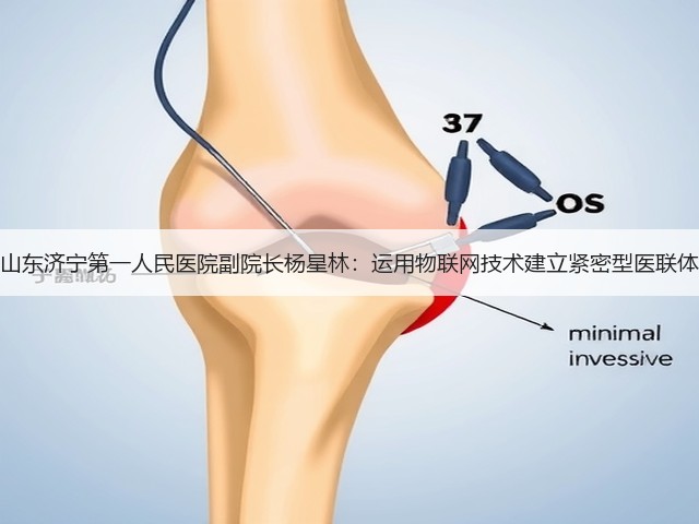 山东济宁第一人民医院副院长杨星林：运用物联网技术建立紧密型医联体(图1)
