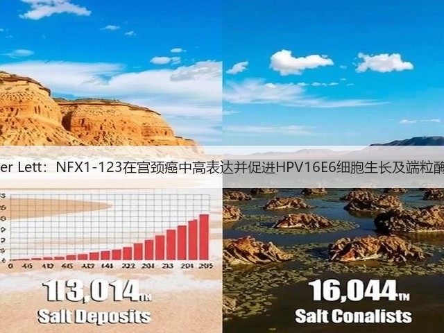 Cancer Lett:NFX1-123在宫颈癌中高表达并促进HPV16E6细胞生长及端粒酶活性(图1) Cancer Lett:NFX1-123在宫颈癌中高表达并促进HPV16E6细胞生长及端粒酶活性(图1)