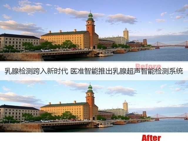 乳腺检测跨入新时代 医准智能推出乳腺超声智能检测系统(图2) 乳腺检测跨入新时代 医准智能推出乳腺超声智能检测系统(图2)