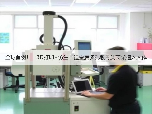 全球首例!“3D打印+仿生”钽金属多孔股骨头支架植入人体(图1) 全球首例!“3D打印+仿生”钽金属多孔股骨头支架植入人体(图1)