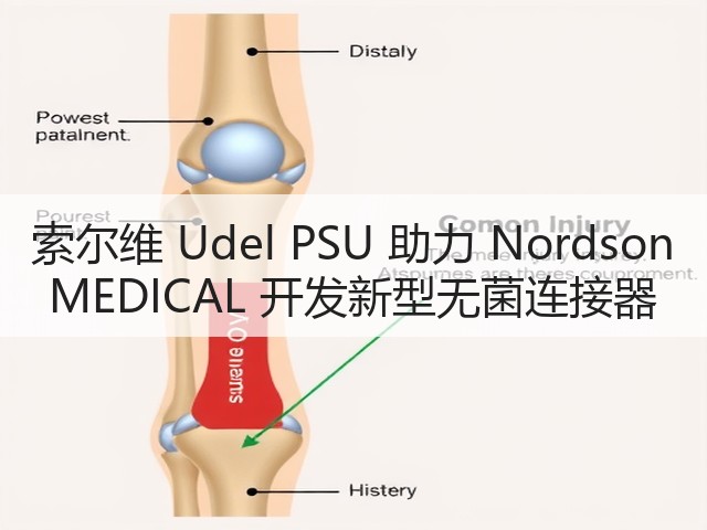 索尔维 Udel PSU 助力 Nordson MEDICAL 开发新型无菌连接器(图3) 索尔维 Udel PSU 助力 Nordson MEDICAL 开发新型无菌连接器(图3)