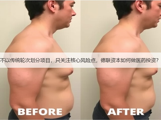 不以传统轮次划分项目,只关注核心风险点,德联资本如何做医药投资?(图3) 不以传统轮次划分项目,只关注核心风险点,德联资本如何做医药投资?(图3)
