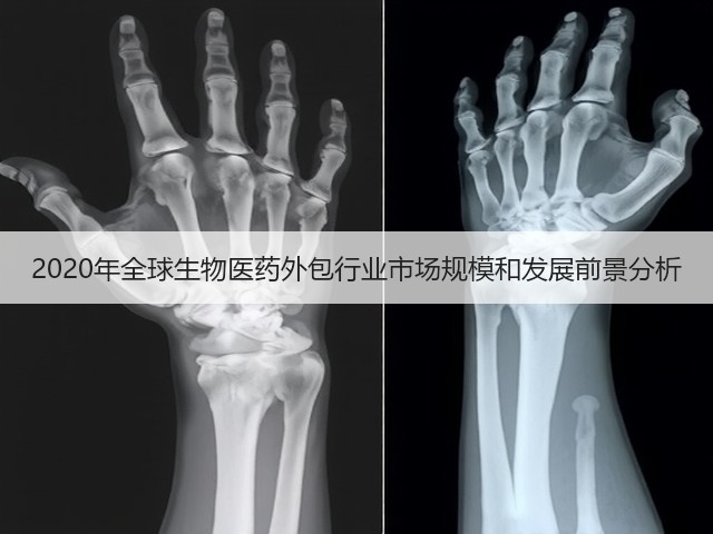 2020年全球生物医药外包行业市场规模和发展前景分析(图3) 2020年全球生物医药外包行业市场规模和发展前景分析(图3)