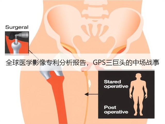 全球医学影像专利分析报告,GPS三巨头的中场战事(图3) 全球医学影像专利分析报告,GPS三巨头的中场战事(图3)