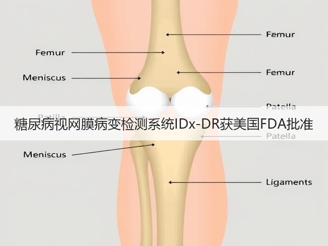 糖尿病视网膜病变检测系统IDx-DR获美国FDA批准(图1) 糖尿病视网膜病变检测系统IDx-DR获美国FDA批准(图1)