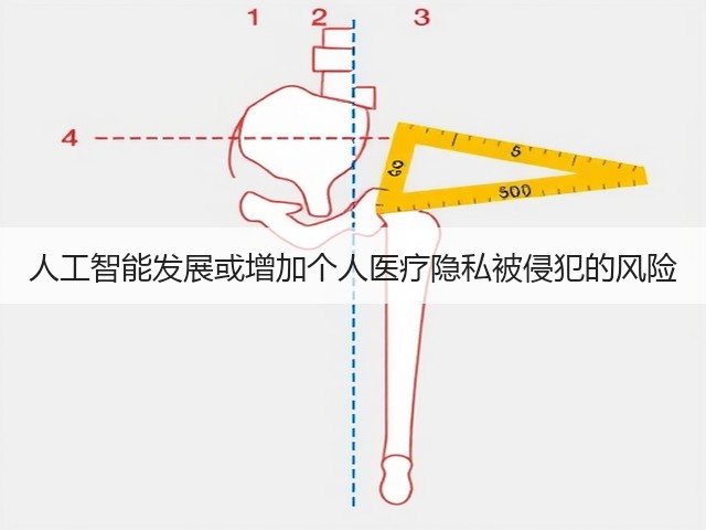 人工智能发展或增加个人医疗隐私被侵犯的风险(图2)