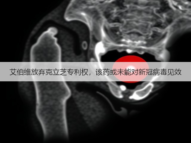 艾伯维放弃克立芝专利权,该药或未能对新冠病毒见效(图1) 艾伯维放弃克立芝专利权,该药或未能对新冠病毒见效(图1)