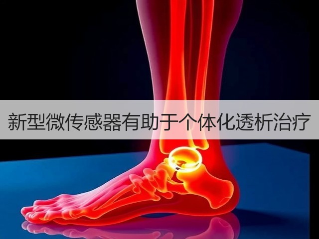 新型微传感器有助于个体化透析治疗(图1)