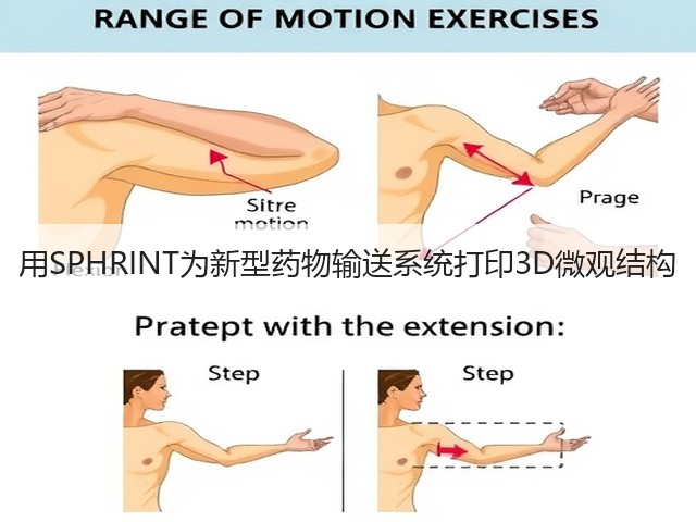 用SPHRINT为新型药物输送系统打印3D微观结构(图1) 用SPHRINT为新型药物输送系统打印3D微观结构(图1)