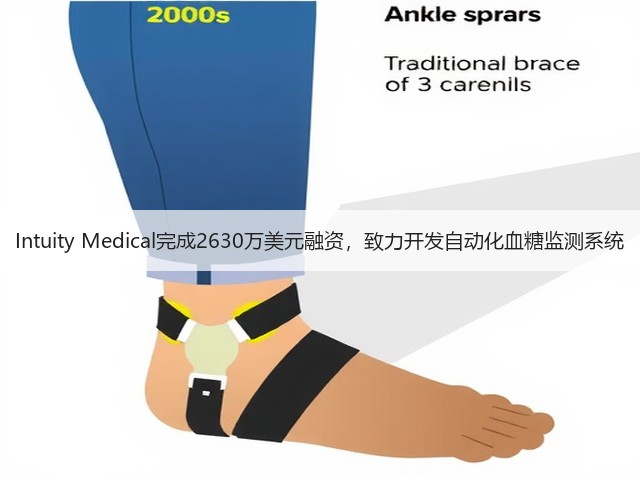Intuity Medical完成2630万美元融资，致力开发自动化血糖监测系统(图3)