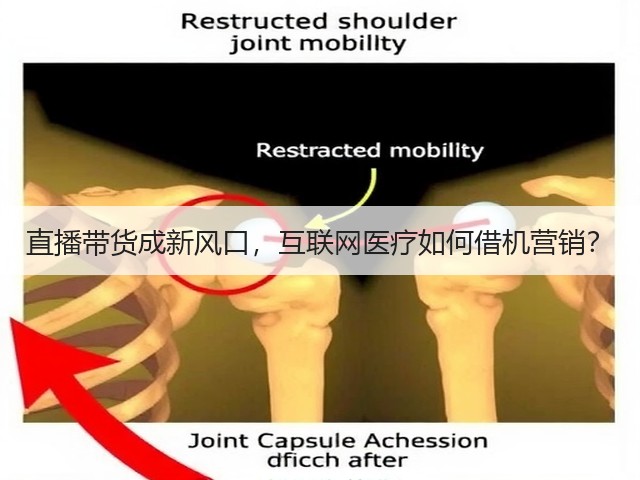 直播带货成新风口,互联网医疗如何借机营销?(图3) 直播带货成新风口,互联网医疗如何借机营销?(图3)