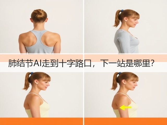 肺结节AI走到十字路口,下一站是哪里?(图3) 肺结节AI走到十字路口,下一站是哪里?(图3)