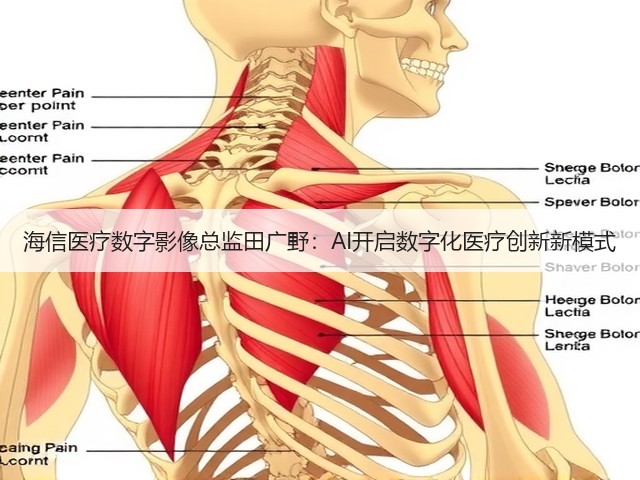 海信医疗数字影像总监田广野:AI开启数字化医疗创新新模式(图3) 海信医疗数字影像总监田广野:AI开启数字化医疗创新新模式(图3)