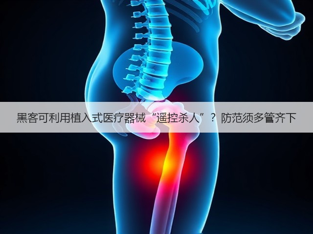 黑客可利用植入式医疗器械“遥控杀人”？防范须多管齐下(图3)