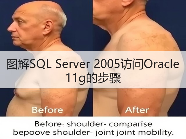 图解SQL Server 2005访问Oracle 11g的步骤(图2) 图解SQL Server 2005访问Oracle 11g的步骤(图2)