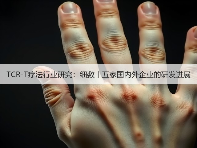 TCR-T疗法行业研究:细数十五家国内外企业的研发进展(图1) TCR-T疗法行业研究:细数十五家国内外企业的研发进展(图1)