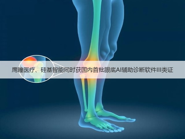 鹰瞳医疗、硅基智能同时获国内首批眼底AI辅助诊断软件III类证(图3) 鹰瞳医疗、硅基智能同时获国内首批眼底AI辅助诊断软件III类证(图3)