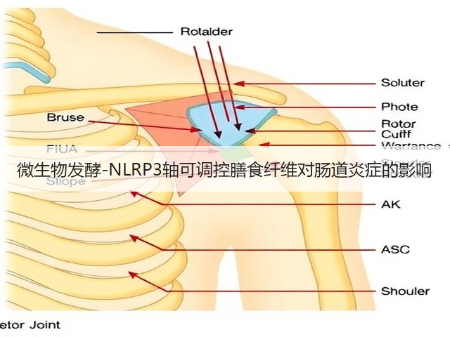微生物发酵-NLRP3轴可调控膳食纤维对肠道炎症的影响(图1)