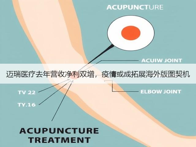 迈瑞医疗去年营收净利双增,疫情或成拓展海外版图契机(图3) 迈瑞医疗去年营收净利双增,疫情或成拓展海外版图契机(图3)