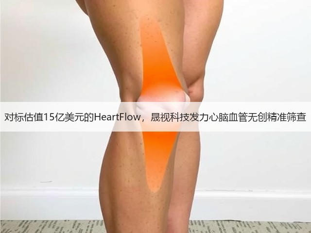 对标估值15亿美元的HeartFlow,晟视科技发力心脑血管无创精准筛查(图2) 对标估值15亿美元的HeartFlow,晟视科技发力心脑血管无创精准筛查(图2)