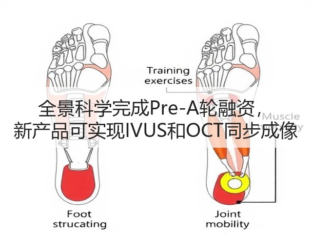 全景科学完成Pre-A轮融资, 新产品可实现IVUS和OCT同步成像(图3) 全景科学完成Pre-A轮融资, 新产品可实现IVUS和OCT同步成像(图3)