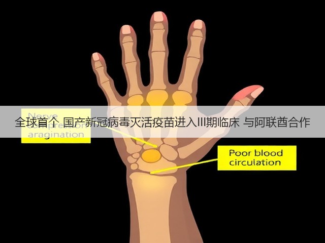 全球首个 国产新冠病毒灭活疫苗进入III期临床 与阿联酋合作(图3) 全球首个 国产新冠病毒灭活疫苗进入III期临床 与阿联酋合作(图3)