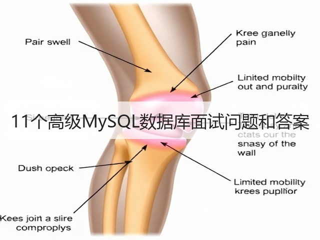 11个高级MySQL数据库面试问题和答案(图1)