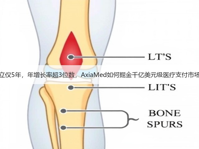 成立仅5年，年增长率超3位数，AxiaMed如何掘金千亿美元级医疗支付市场？(图1)